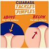 Clearasil Stubborn Acne Control 5-in-1 Spot Treatment Cream-4