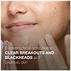 Neutrogena Oil-Free Acne Wash Facial Scrub Pink Grapefruit-4