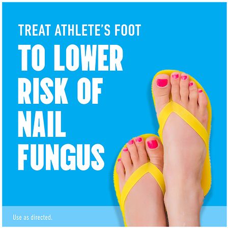 Mightlink 20g/30ml Athlete Foot Spray Anti-Fungal Relief Foot Disease Skin  Care Toe Treatment Foot-repair Foot-care Antibacterial Reduce Itching Foot