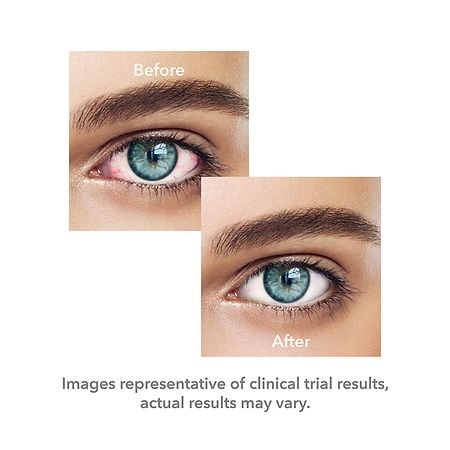 Bausch + Lomb Lumify Redness Reliever Eye Drops