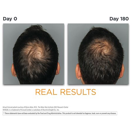 Viviscal Man Hair Growth Supplement | Walgreens