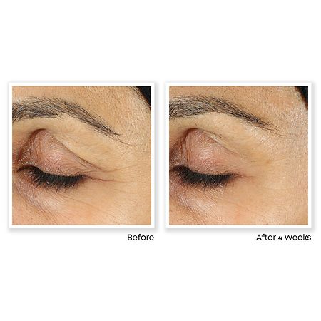 RoC Retinol Correxion Line Smoothing Eye Cream Walgreens