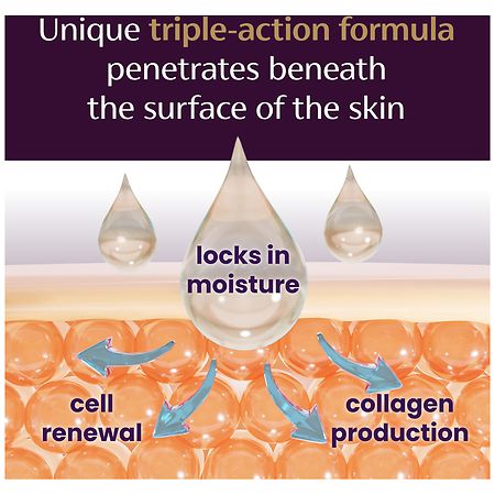 Mederma Stretch Mark Therapy Prevention & Treatment