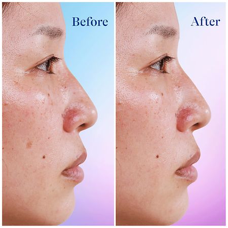 Differin Dark Spot Correcting Serum